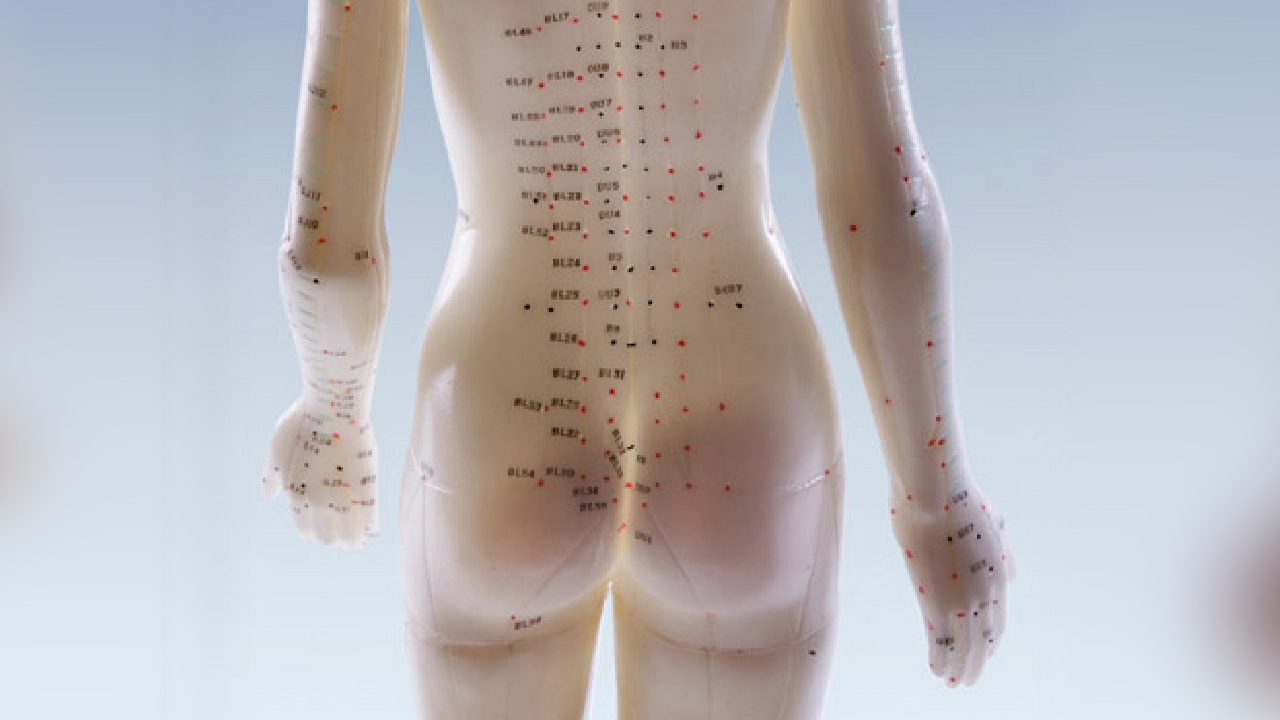 Best Acupuncture London
