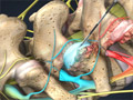 Facet Joint Injections