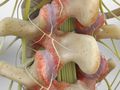 Facet Joint Syndrome