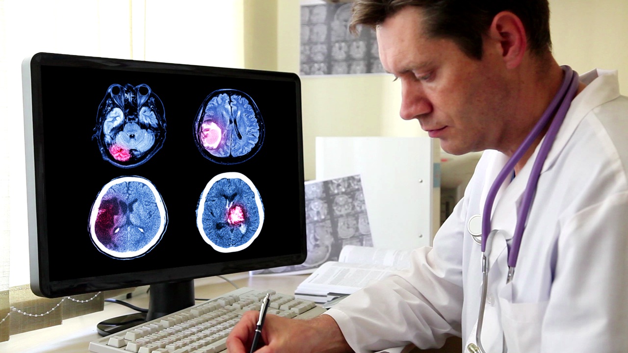 treatment for brain tumor